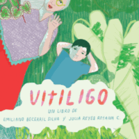 VITILIGIO